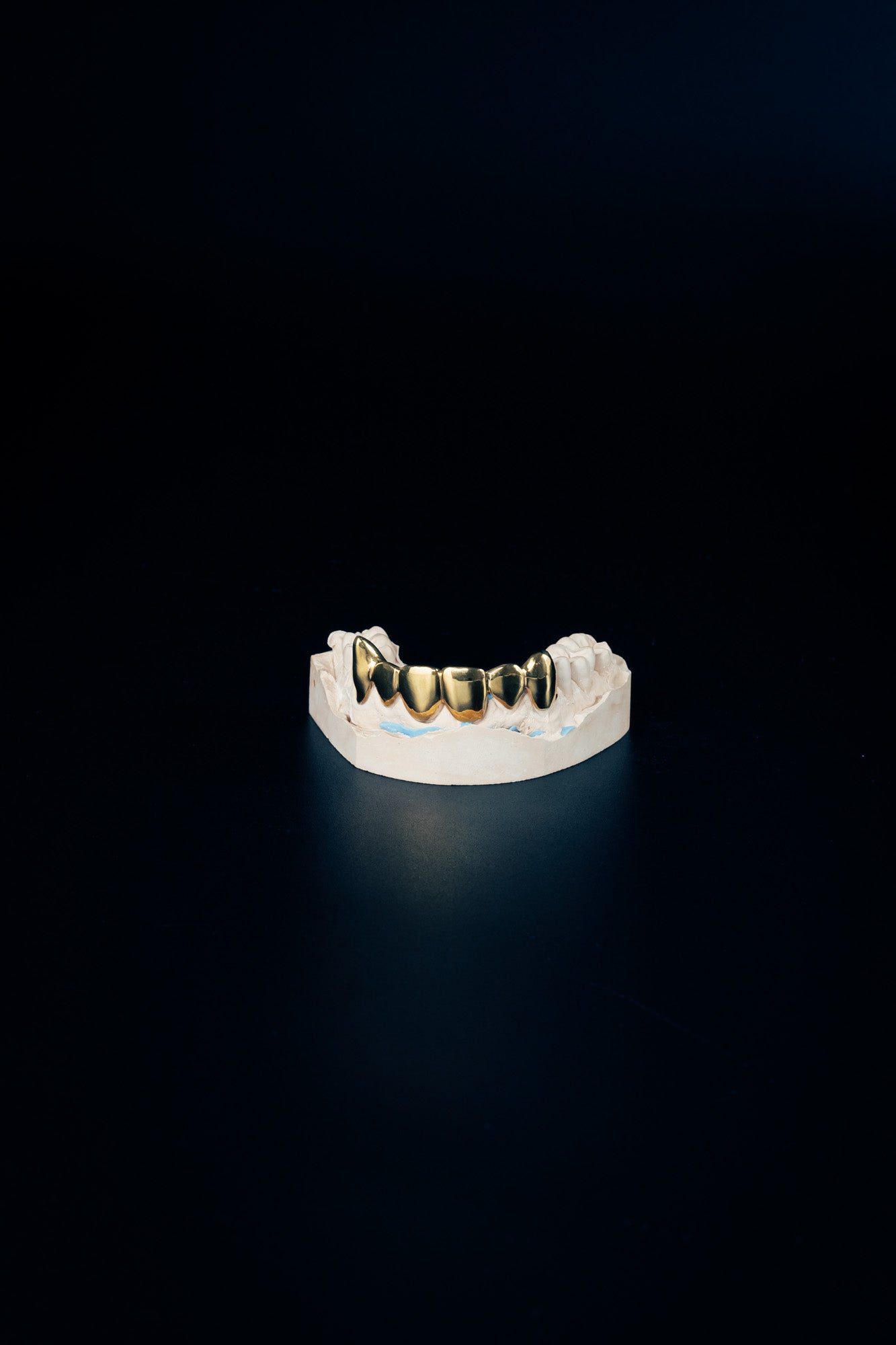 "Chrome Grillz – 8 Piece Set"