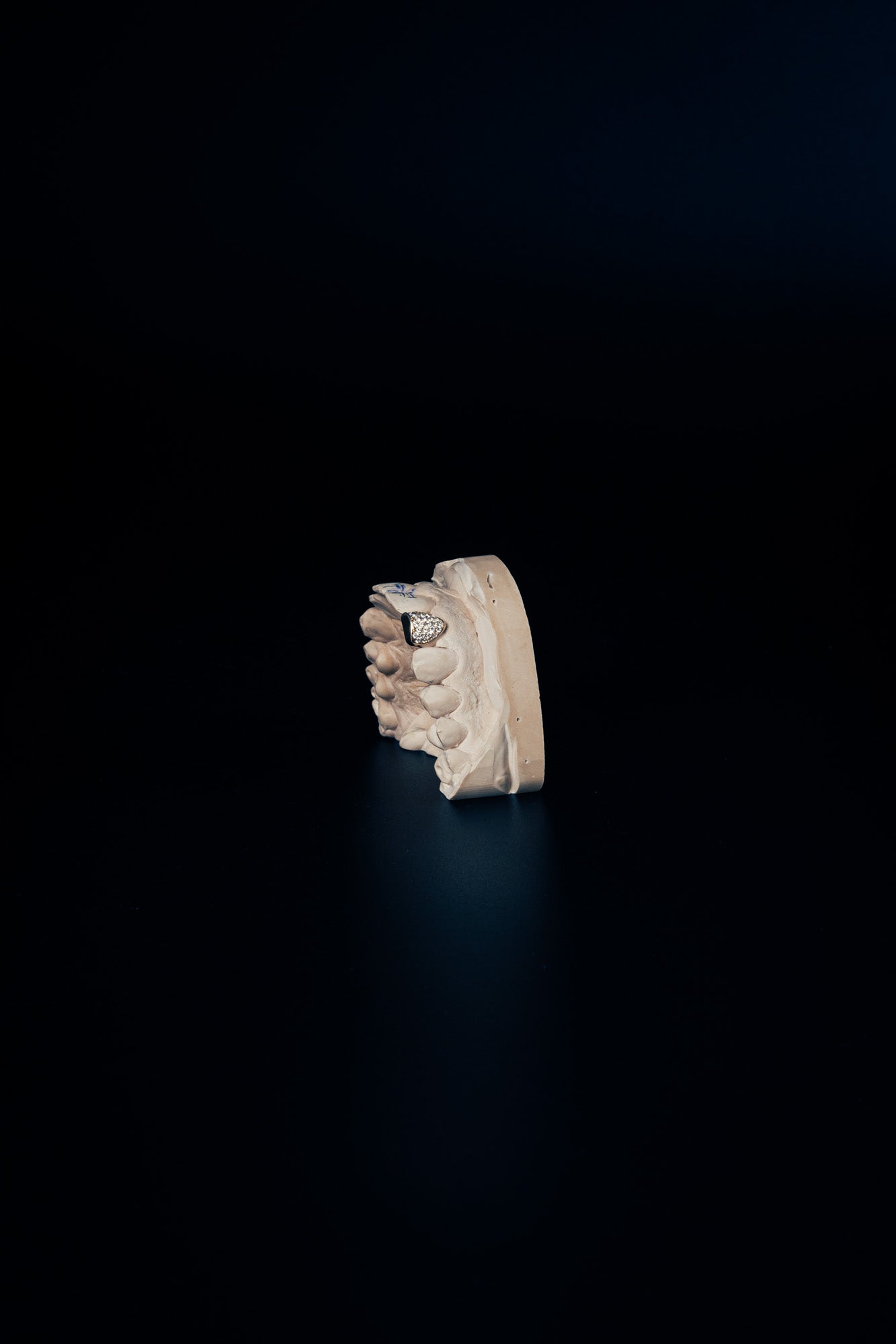 Full-ice grillz