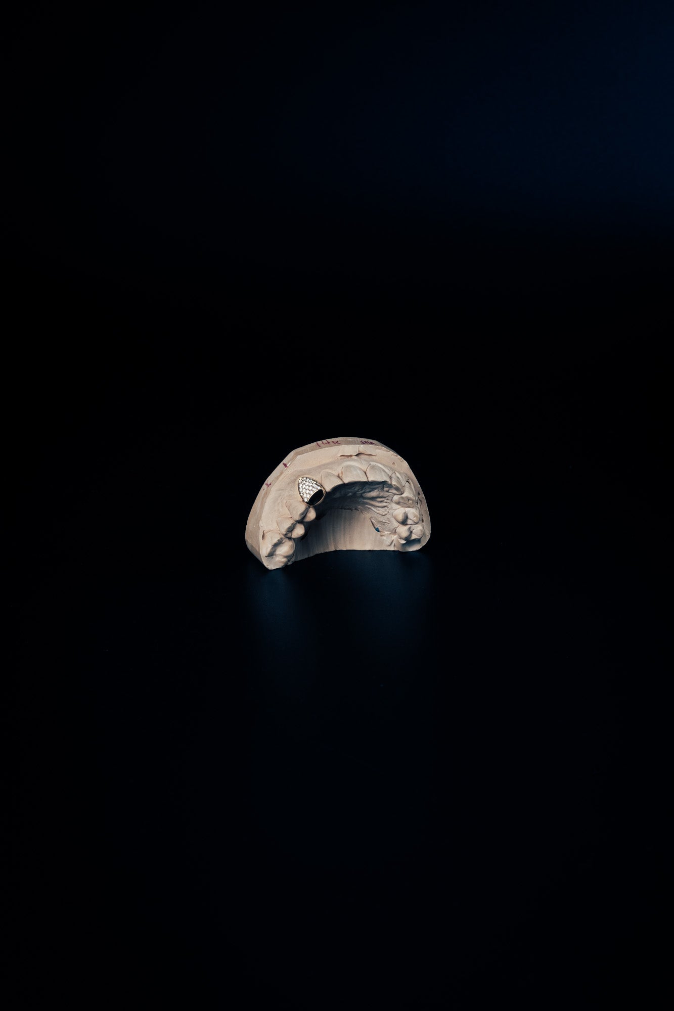 Full-ice grillz