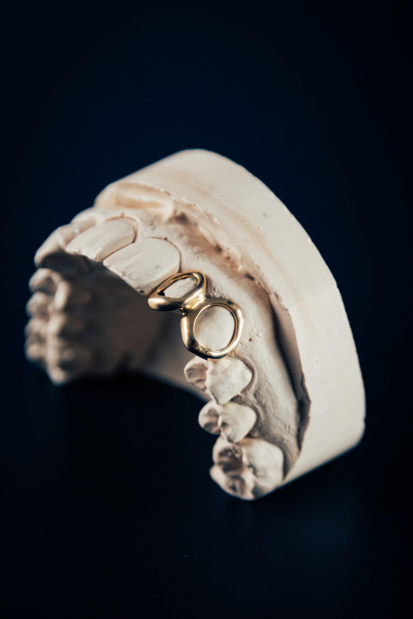 Gold Grillz window