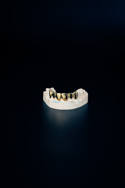 "Chrome Grillz – 8 Piece Set"