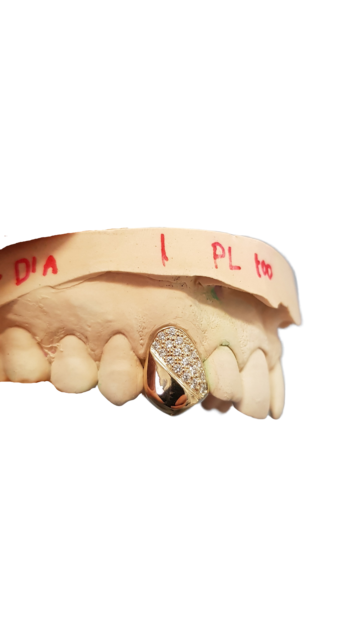 Diamond Grillz – Half Set