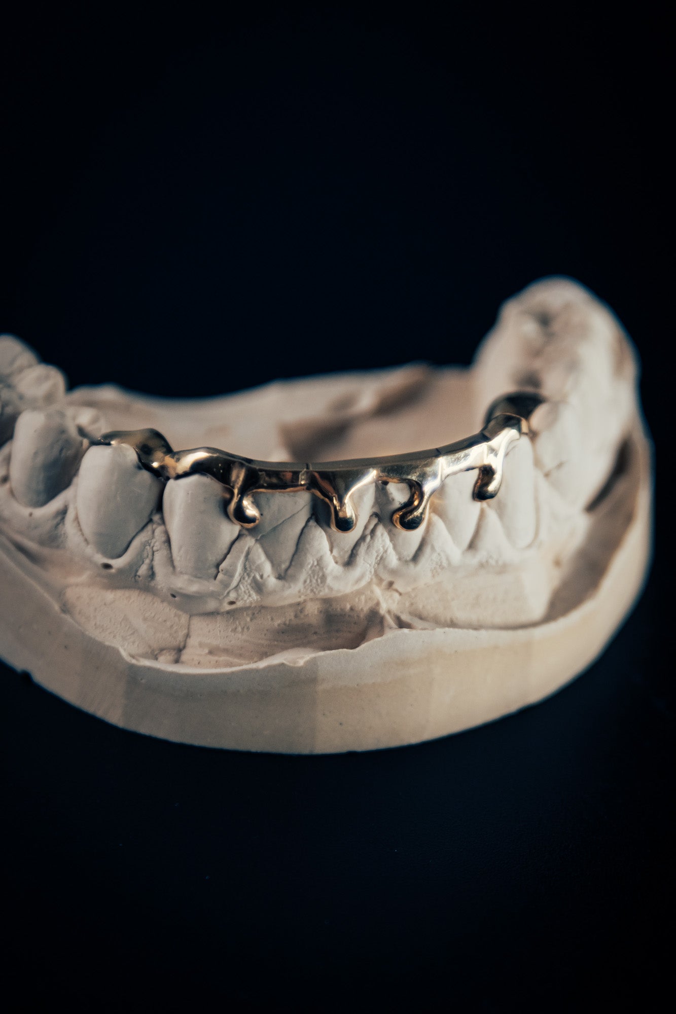 "Drip" (4 teeth)