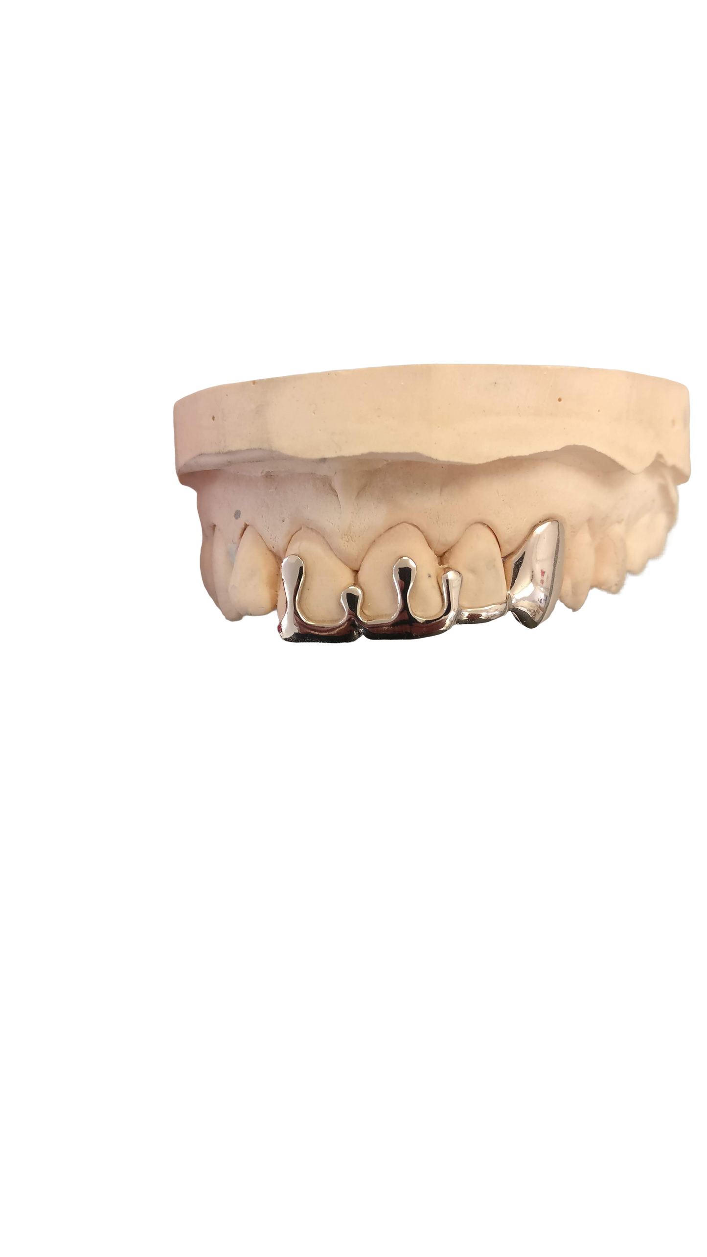 "Drip" (4 teeth)