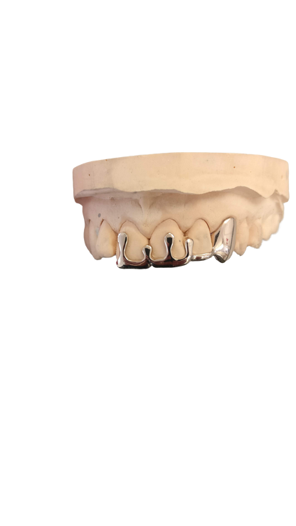 "Drip" (4 teeth)
