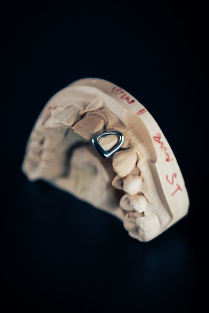 Gold Grillz window