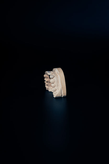 Full-ice grillz