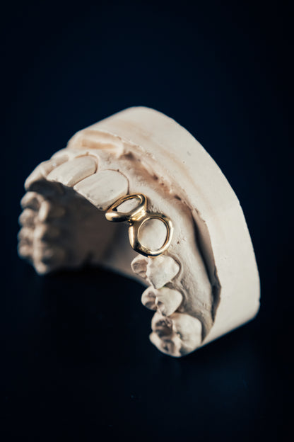 Gold Grillz window